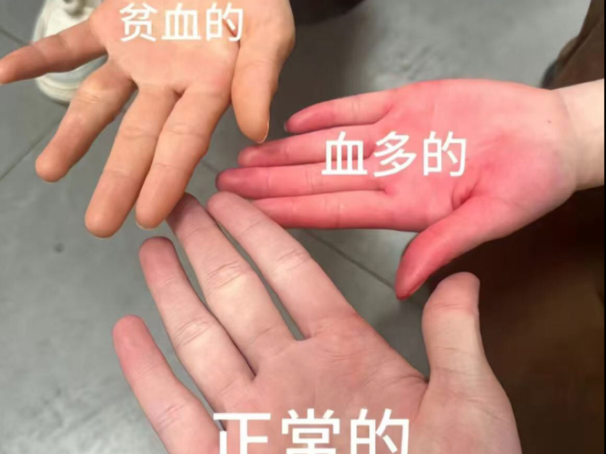 Vocal.. 原來這種的是氣虛啊？